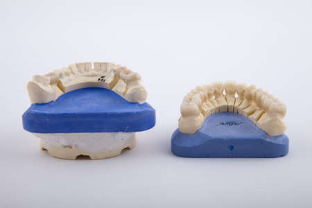 model of the jaw with a prosthesis on a white backgroundの写真素材
