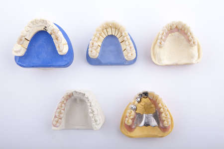 various models of jaw on a white background