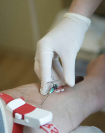 This is a procedure of blood sampling from vein  The gloved hand,  syringe needle, test-glass 	and  patientのeditorial素材