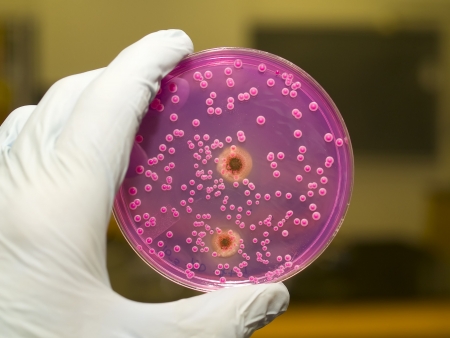 Yeast And Molds