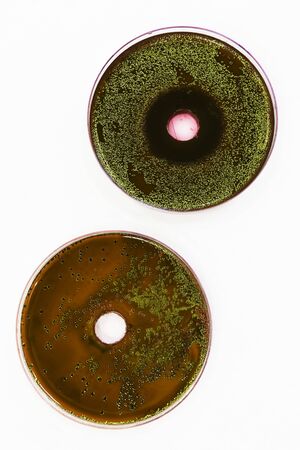 Zone of inhibition produced by Lingonberry extract on an EMB agar plate containing E. coli and a...