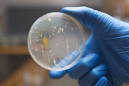 Sewage bacteria growing on an agar plate.の写真素材