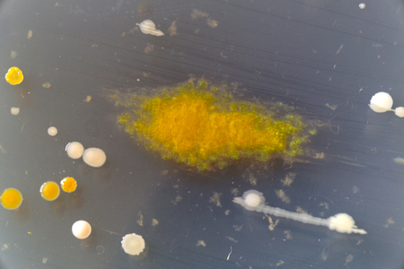 Macro image of sewage bacteria.