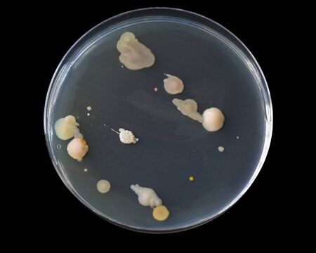 Sewage bacteria on black background.の写真素材