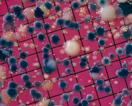 Escherichia coli colonies growing on an agar plate.の写真素材