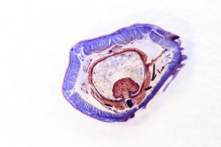 Cross section of an earthworm.の写真素材