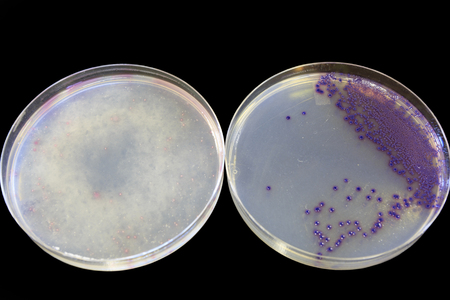 Food safety - 2 agar plates with one showing positive for E coli and one negative.