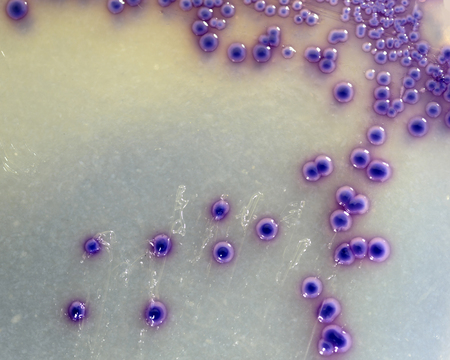 Foos safety pathogen E. coli growing on a agar plateの写真素材