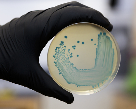 Food safety pathogen Listeria monocytogenes isolated on agar from a food sample.