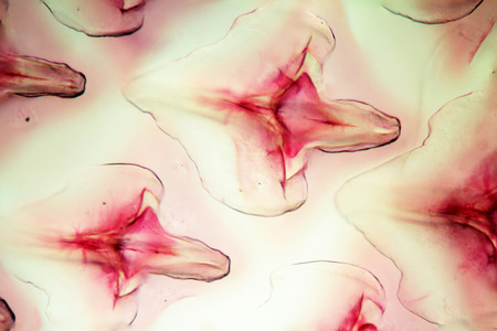 Fish scales found on sharks and rays