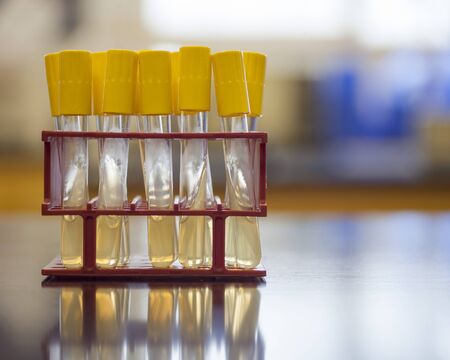 Agar slant for growing microorganisms.の写真素材