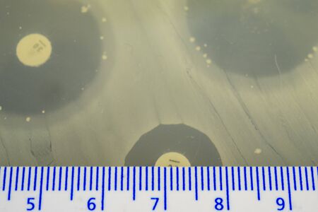 Measuring the zone on inhibition on a perti plate.の写真素材
