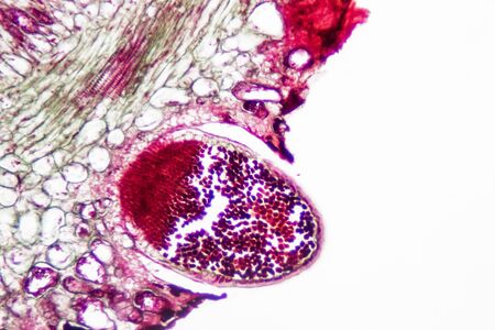 Parasitic plant fungus Puccinia microscope slide.