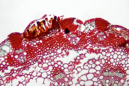 Parasitic plant fungus Puccinia showing teliaspores on a microscope slide.