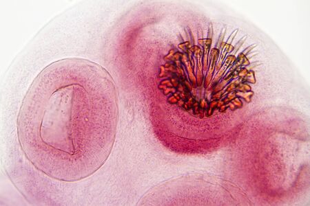 The suckers and hooks of a young tapeworm.