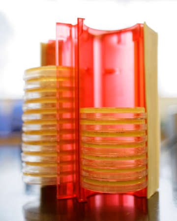 A rack of Petri dishes on a lab bench.の写真素材