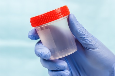 Laboratory worker holding jar with urine sample on lightの写真素材