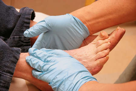 Elderly senior woman wearing denim jeans gets her feet examined by podiatrist, wearing blue medical gloves. Horizontal.の写真素材