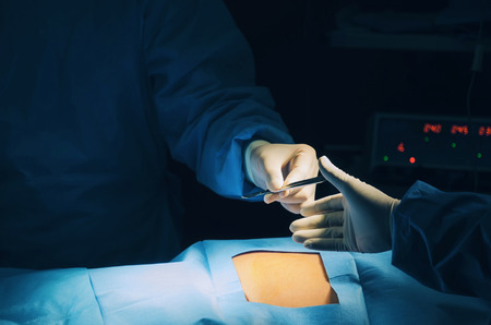 Doctor and Assistant surgeons team working for rescue patient with ECG/EKG monitor in operation room at hospital, emergency case, surgery, medical technology, health care cancer and disease conceptの写真素材