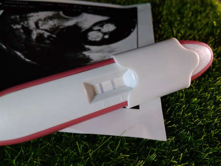 pregnancy test pack positive result at green grassの写真素材