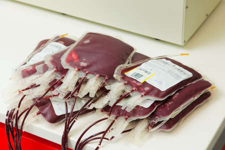 Blood from blood donors in the blood lab. Health and Welfare.の写真素材
