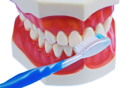 a dental model with a toothbrush when brushing teeth. brushing prevents caries.