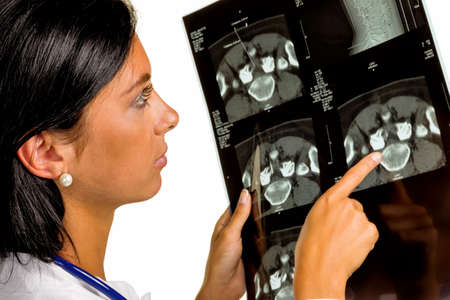 a female doctor holding x-ray image of a disc infiltration in hand.