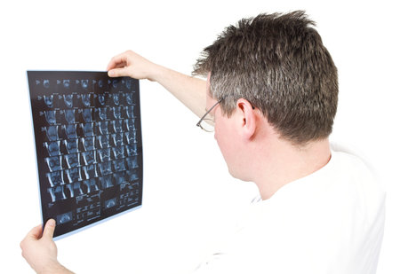 Doctor viewing MRI scans with isolated backgroundの写真素材