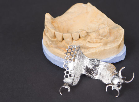 Dental cast moulds on a black background
の写真素材