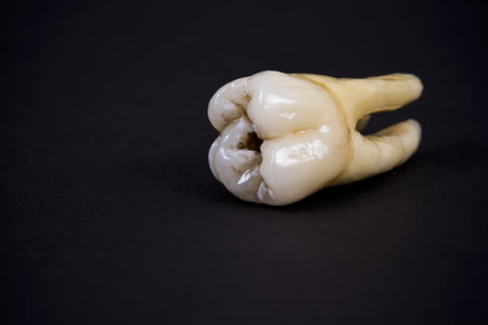 artificial ceramic molar teethの写真素材