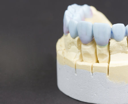 closeup for a mock up of a dental circular bridgeの写真素材