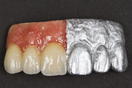 artificail ceramic front teeth and gumsの写真素材