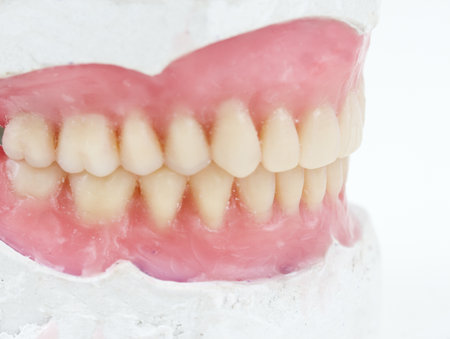 mock- up, for, denta,l total, prosthesis,の写真素材