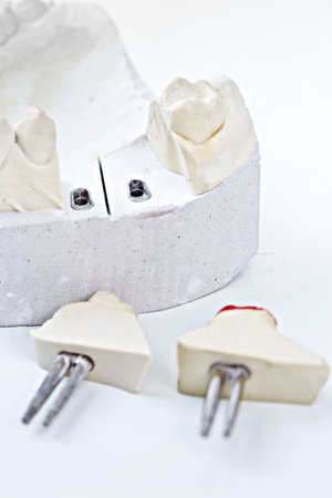 gypsym model with removable partsの写真素材