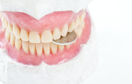dental prsothesis ona  gypsum model biting   a coin の写真素材