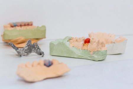 dental cast model in a laboratory with a waxep up toothの写真素材