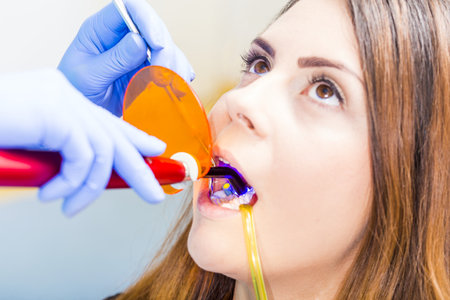 Beautiful woman patient having dental treatment at dentist's office.の写真素材