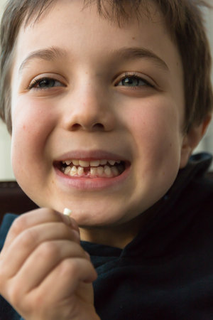 Young boy with missing front tooth, waiting for tooth fairyの写真素材