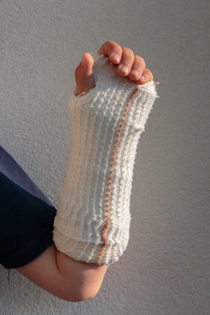 Eight Years Old Child Keeps Broken Arm in Gypsumの写真素材