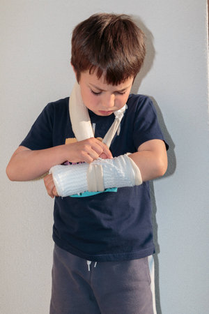 Eight Years Old Child Keeps Broken Arm in Gypsumの写真素材