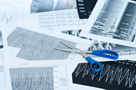 Numerical and graphical data simulating a financial studyの写真素材