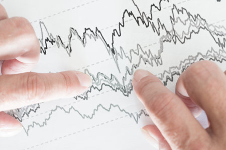 Simulation of a financial study