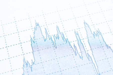 Graphic detail stock exchange market indicators