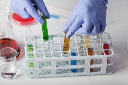 The lab technician in rubber gloves takes samples for further testing.