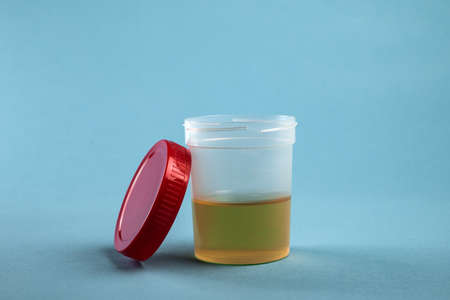 urine analysis for a test in a plastic jarの写真素材
