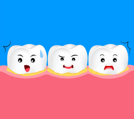 Tooth character periodontal disease with plaque or tartar. Dental care concept. cute cartoon, illustration.のイラスト素材