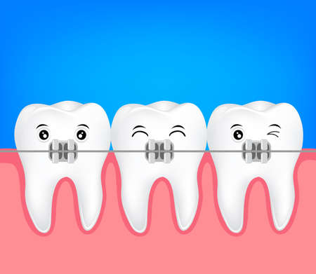 Teeth braces illustration. Dental health care concept.のイラスト素材