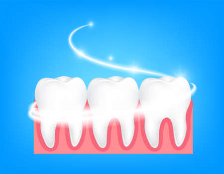Whitening of human tooth. Deep cleaning, clearing tooth process. Dental health concept. Oral Care, teeth restoration. illustration on blue background.のイラスト素材