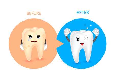 Cartoon tooth character before and after. Whiten yellow teeth. Dental care concept,  illustration.のイラスト素材