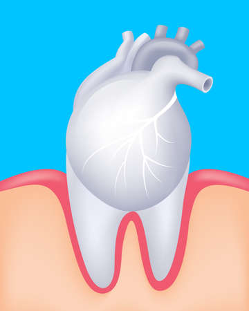 Human heart and tooth as a partner.  Oral health and heart disease hygiene concept caused by dental plaque and gum disease due to mouth bacterial infection. Vector illustration isolated on blue background.のイラスト素材
